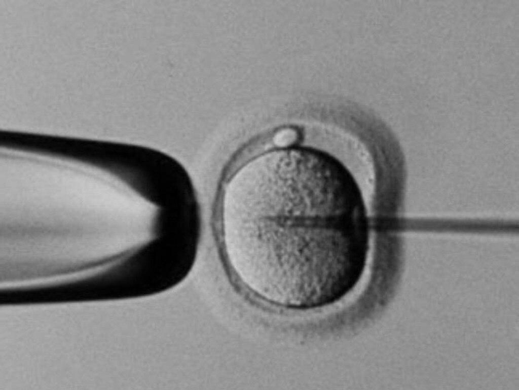 ivf-cash-rebate-eligibility-criteria-revealed-as-scheme-opens-oct-1