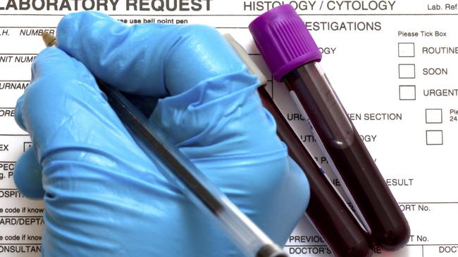 Patients have won a temporary reprieve from a new $30 charge for a blood test. Picture: istock