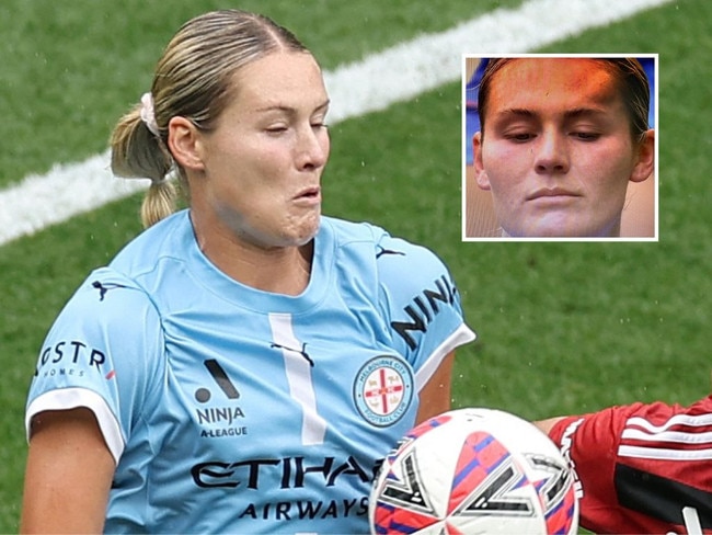 Melbourne City's Taylor Otto was involved in a brutal head clash.