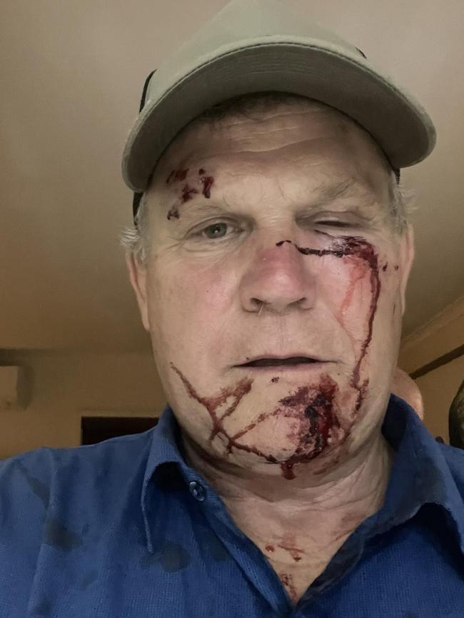 Former Barron River MP Michael Trout has been charged in relation to a brawl in Holloways Beach in May, 2024. Picture: Supplied