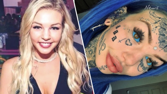 A model tattooed her eyeball purple. She now could lose her eye.