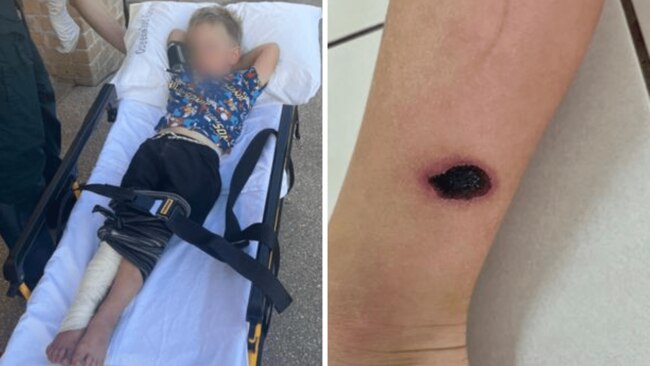 The Queensland toddler was bitten by one of the world's deadliest snakes. Source: 7News