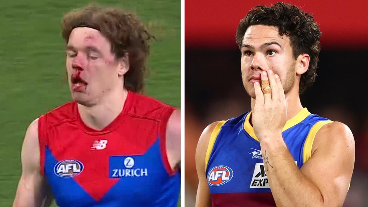 Ben Brown was left bloodied from a Cam Rayner tackle that saw the Lion reported.