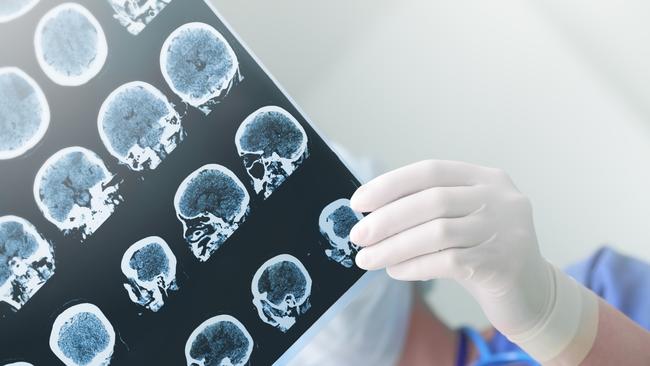 Praxis Precision Medicines will focus on treatments for brain diseases at its Melbourne headquarters. Generic picture: iStock