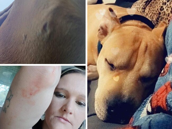 ‘So much blood’: Woman’s trauma after vicious puppy mauling