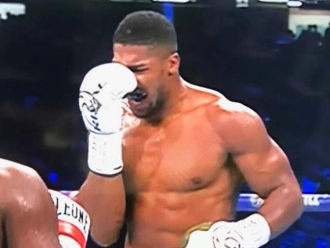 Anthony Joshua is in a world of pain.