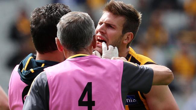 Grant Birchall suffered a fractured jaw after being hit in the head by Crow Tom Lynch. Picture: Michael Klein