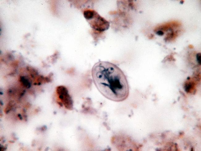Microspic parasite giardia lamblia that causes giardiasis disease has ben found in Sydney's drinking water, 07/98.NSW / Medical