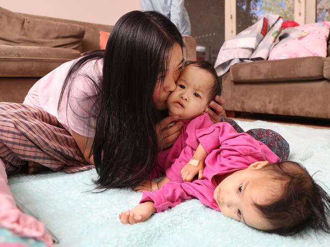 HERALD SUN ONLY-----4/10/2018. Bhutan Conjoined Twins.   Mum Bhumchu Zangmo with Nima [left], and Dawa [right] at the Children First Foundation, after a visit to the Royal Children's Hospital for scans and various tests under aesthetic.  Dawa has scrathes on her face from her dominant sister. Picture: Alex Coppel.