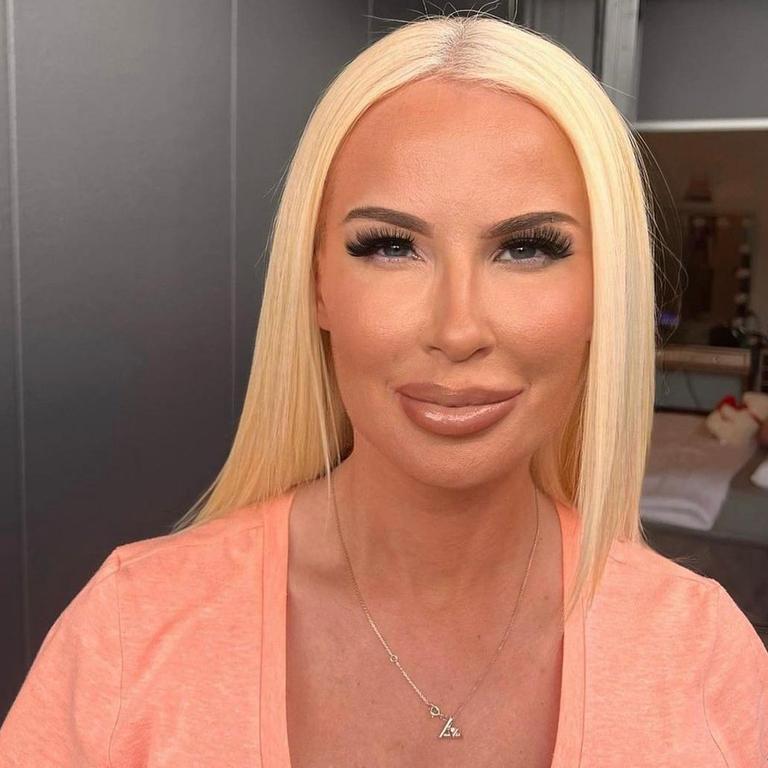 Juliet Young first came to prominence after a chain of 18 cosmetic treatment clinics called Injectable Institute Australia went under in February. Picture: Supplied