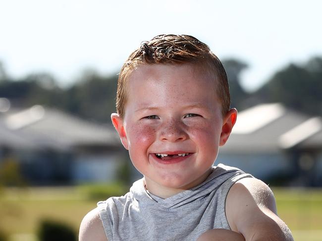 Chase Green 6 was rushed to hospital at 4 years of age with a bulging tummy and tonsillitis which turned out to be at 13 cm tumor in the kidney which required urgent surgery. He is now in remission and is a happy and healthy kid, pictured at Spring Farm in south west Sydney. Picture: Toby Zerna