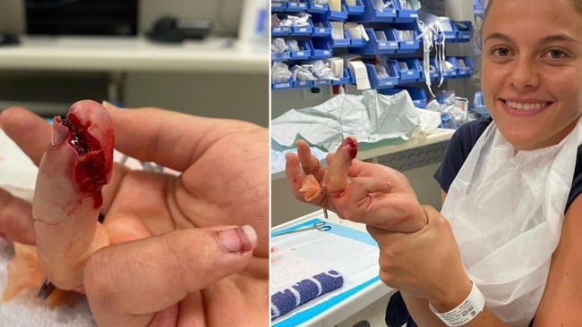 Rosie Malone in a New Zealand hospital after sustaining a horror injury to her finger during a game. Photo: Instagram