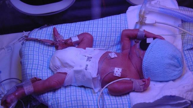 Jake Richardson was born 12 weeks premature with complications including multiple brain bleeds. Photo: Supplied.