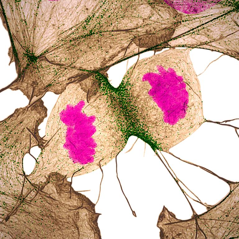 11th Place Human fibroblast undergoing cell division Picture: Nilay Taneja &amp; Dr. Dylan Burnette