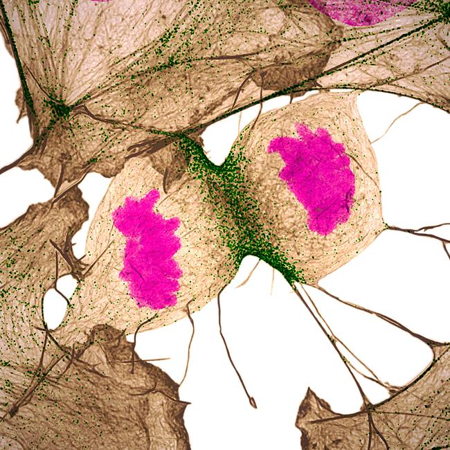 11th Place Human fibroblast undergoing cell division Picture: Nilay Taneja & Dr. Dylan Burnette