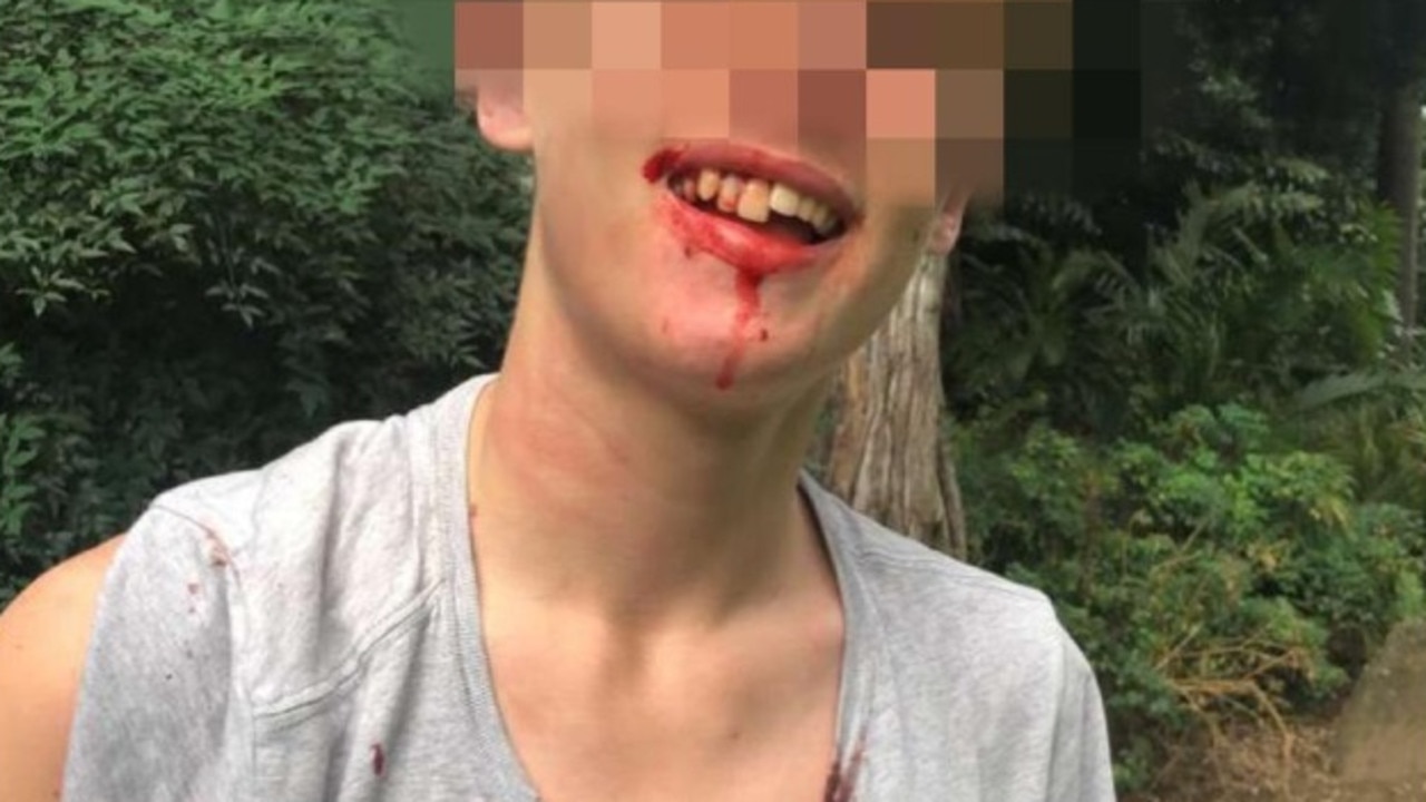 An image of a bloodied student from another school, after being involved in a fight with a student from Brisbane State High School. Picture: Supplied