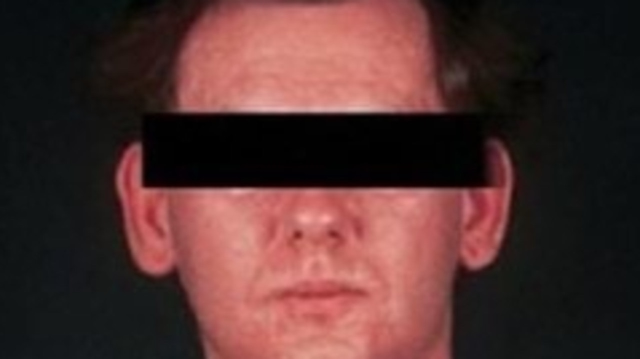 A person with measles.