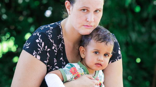 Shauna Mounsey with her son Lloyd Jayathilaka who was attacked by an unrestrained dog in the Botanical Gardens. Picture: Glenn Campbell