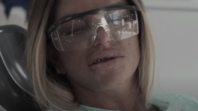 Katie Price shows off her real teeth in dentist’s chair.