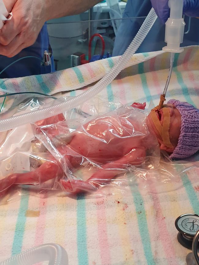 Lawson Troughton was born at 24 weeks weighing just 790 grams. He spent 100 days in the NICU at Royal Hobart Hospital.