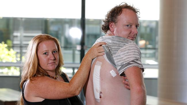 Shark attack survivor Jabez Reitman and his wife Katherine Reitman talking about the shark attack that happened on Sunday at Byron Bay, NSW. Picture: JERAD WILLIAMS