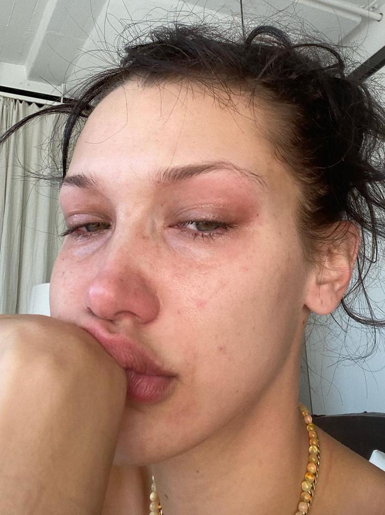 Bella Hadid detailed her "excruciating" struggle with mental health on Instagram last year. Picture: Instagram.