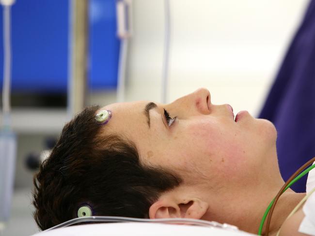 Natalie Kellalea before undergoing a world-first procedure to deliver epilepsy drugs directly to her brain. Picture: Andrew Tauber