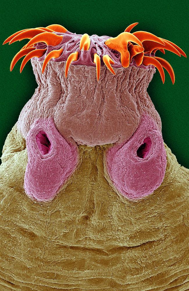 Peek-a-boo! Common intestinal parasite: The tapeworm. Picture: Supplied