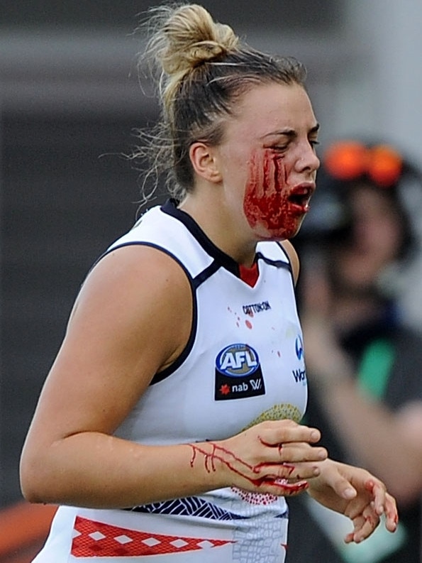 Crows midfielder Ebony Marinoff leaves the ground bleeding from under her eye against Fremantle Dockers at TIO Stadium in Darwin last year. Photo: Felicity Elliott/AFL Media