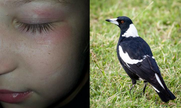 Magpie Swooping Season Warning A Magpie Almost Blinded My Son Kidspot