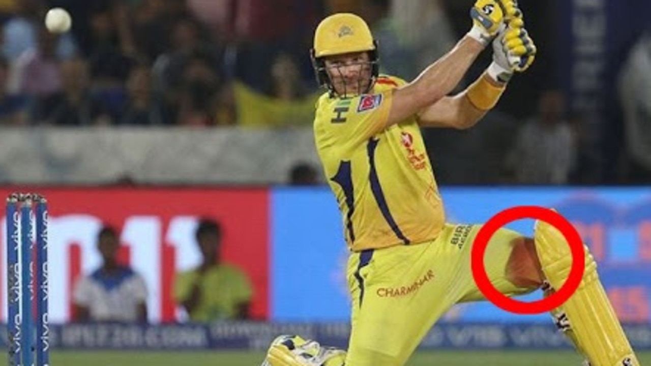 Shane Watson put his body on the line.