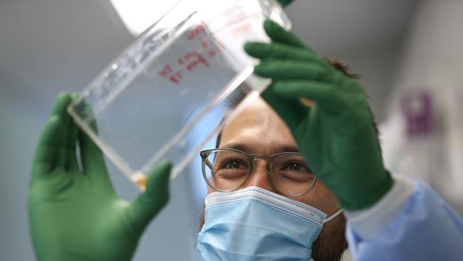 Doctor Jesse Erasmus checks vero cells as he works on the development of a replicon, or replicating, RNA vaccine, used to combat COVID-19 (SARS-CoV-2). Picture: AFP