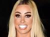 Katie Price unrecognisable after new facelift