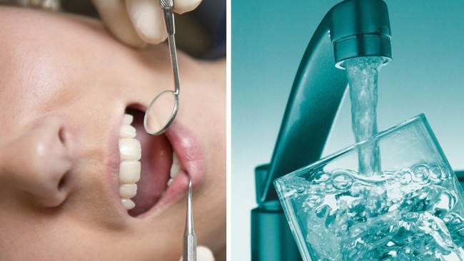 ‘Keep our yokels toothless!’: Council’s fluoride vote divides