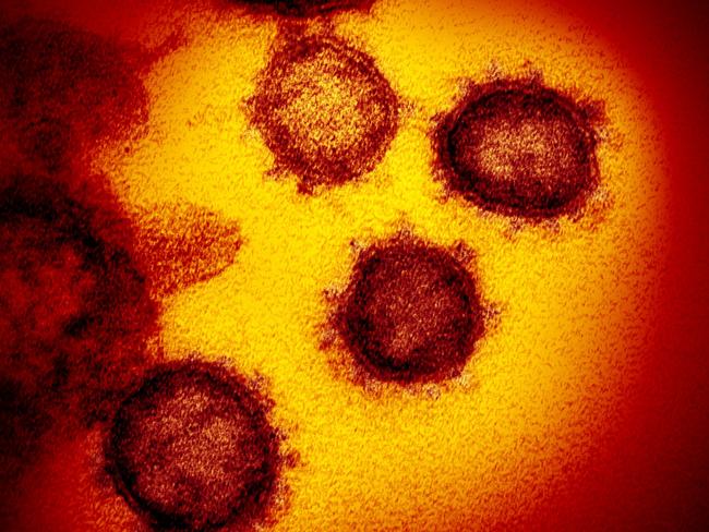 What SARS-CoV-2, the virus that causes COVID-19, looks like. Picture: AFP/National Institutes Of Health