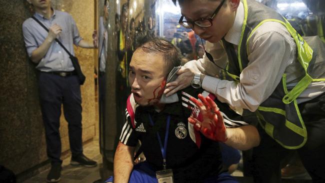 A volunteer medic attends to a wounded Andrew Chiu. Picture: AP