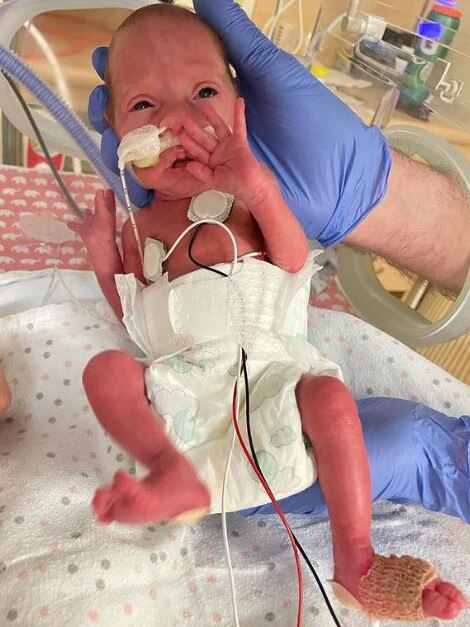 Rylee was born in August, at only 28 weeks, weighing 858g, and spent the next six weeks in an Adelaide hospital. Picture: Megan Schutt Instagram