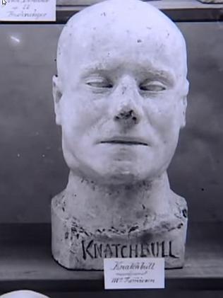 Murderer John Knatchbull’s death mask, made after his hanging at Darlinghurst.