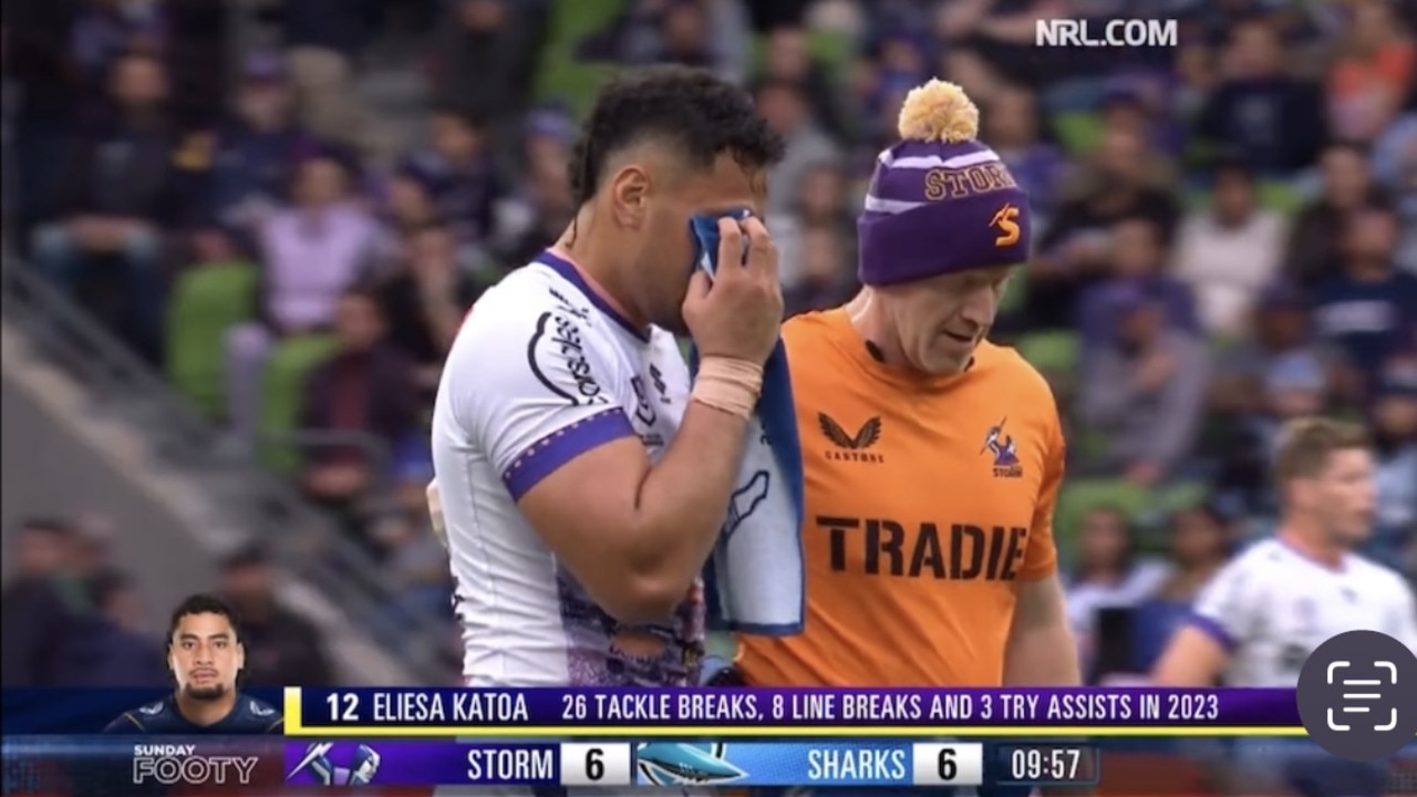 The ‘harmless’ tackle that almost blinded an NRL star