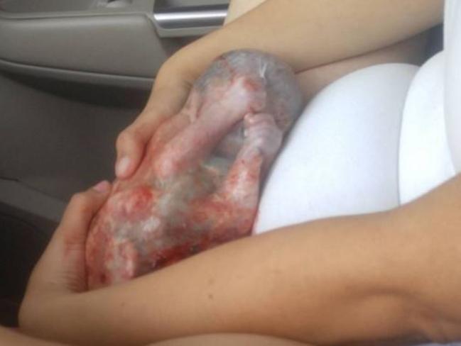 Mum shares incredible birth pic. Picture: Instagram/Raeee_nacoal23