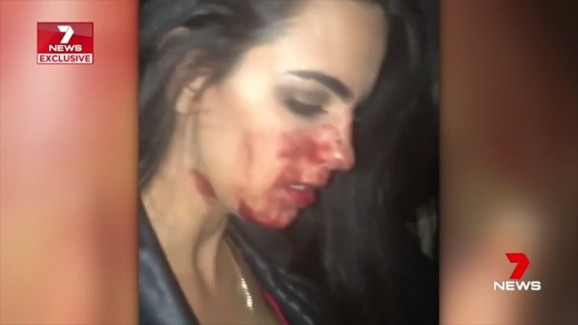 Woman, 28, left bleeding after alleged Uber driver attack (7News)