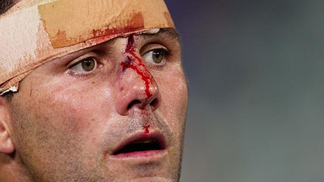 Michael Gordon had a horror night in round one, but is worth persisting with. Picture: Jenny Evans