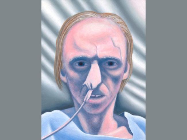 Self-portrait with nose tube by Chris O’Doherty (AKA Reg Mombassa) is a self-portrait by the legendary artist of Mambo fame. He was also a founding member of Mental as Anything. Picture: Reg Mombassa, Archibald 2025, Photo: Art Gallery of New South Wales, Jenni Carter