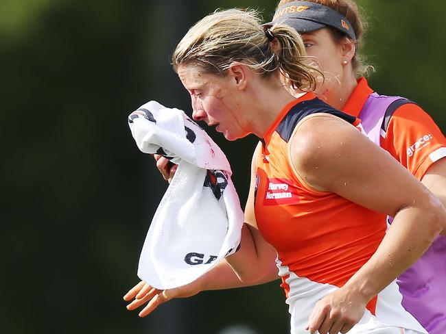 MELBOURNE, AUSTRALIA - FEBRUARY 18:  Cora Staunton of GWS comes off with a facial injury after trying to tackle Sophie Casey of the Magpies during the round three AFLW match between the Collingwood Magpies and the Greater Western Sydney Giants at Olympic Park on February 18, 2018 in Melbourne, Australia.  (Photo by Michael Dodge/Getty Images)