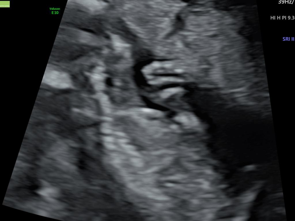 Side profile of baby holding his hand up in front of his neck.