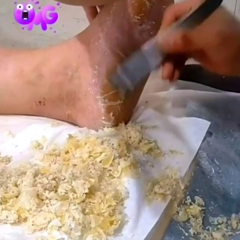 Gross moment beautician shaves off mountains of dry skin on client's feet, video