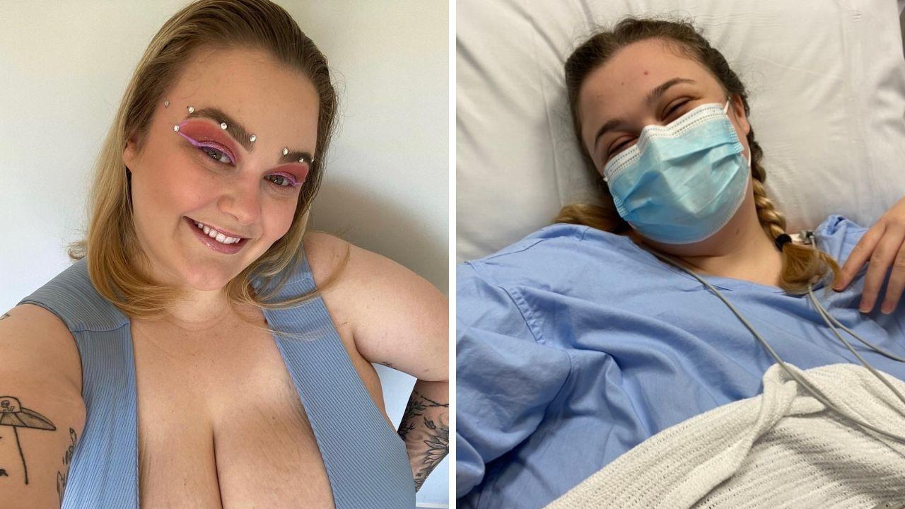 Daily Star on X: Plus-size model with 36G boobs SLAMMED for getting breast  reduction   / X
