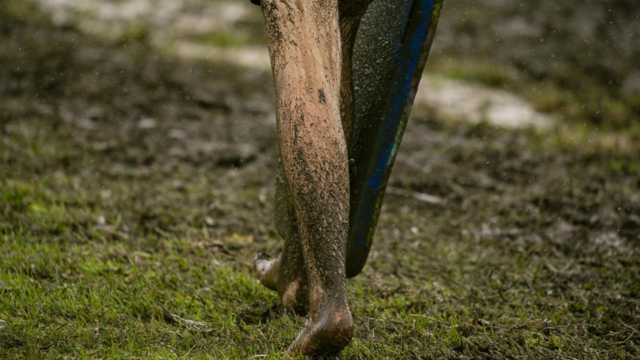 James Cook University head of biomedical sciences and molecular biology Jeffrey Warner said Cairns had a huge rise in the number of melioidosis cases but near average rainfall. Picture: NewsWire / Glenn Campbell