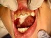 Health service drills Far North council over fluoride meeting
