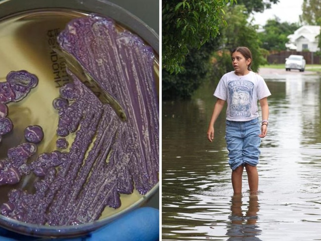 Nine people in Cairns and three in Townsville have died from a rare soil-borne disease, with the flood-ravaged region facing a “record-breaking” surge in cases.